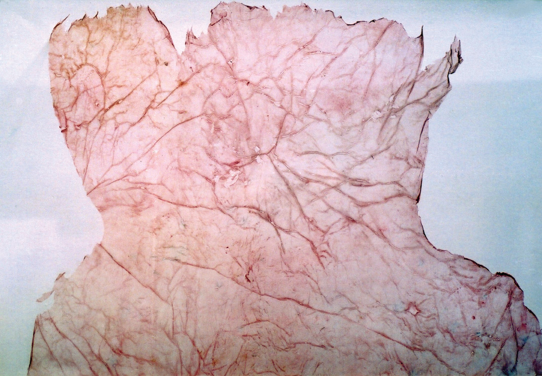 Valérie Novello - Peaux sous verre