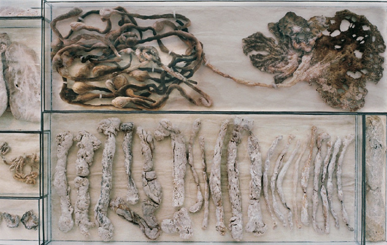 Valérie Novello - Viscères